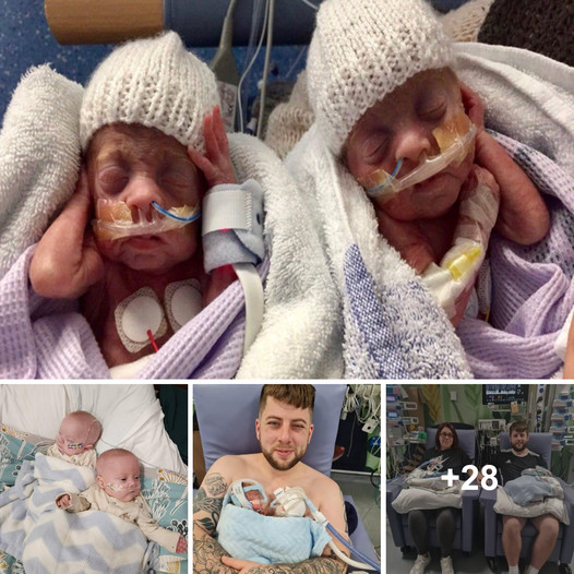 Miraculous Reunion: Preemie Twins Defy the Odds, Born at 24 Weeks, Return Home After 150 Days